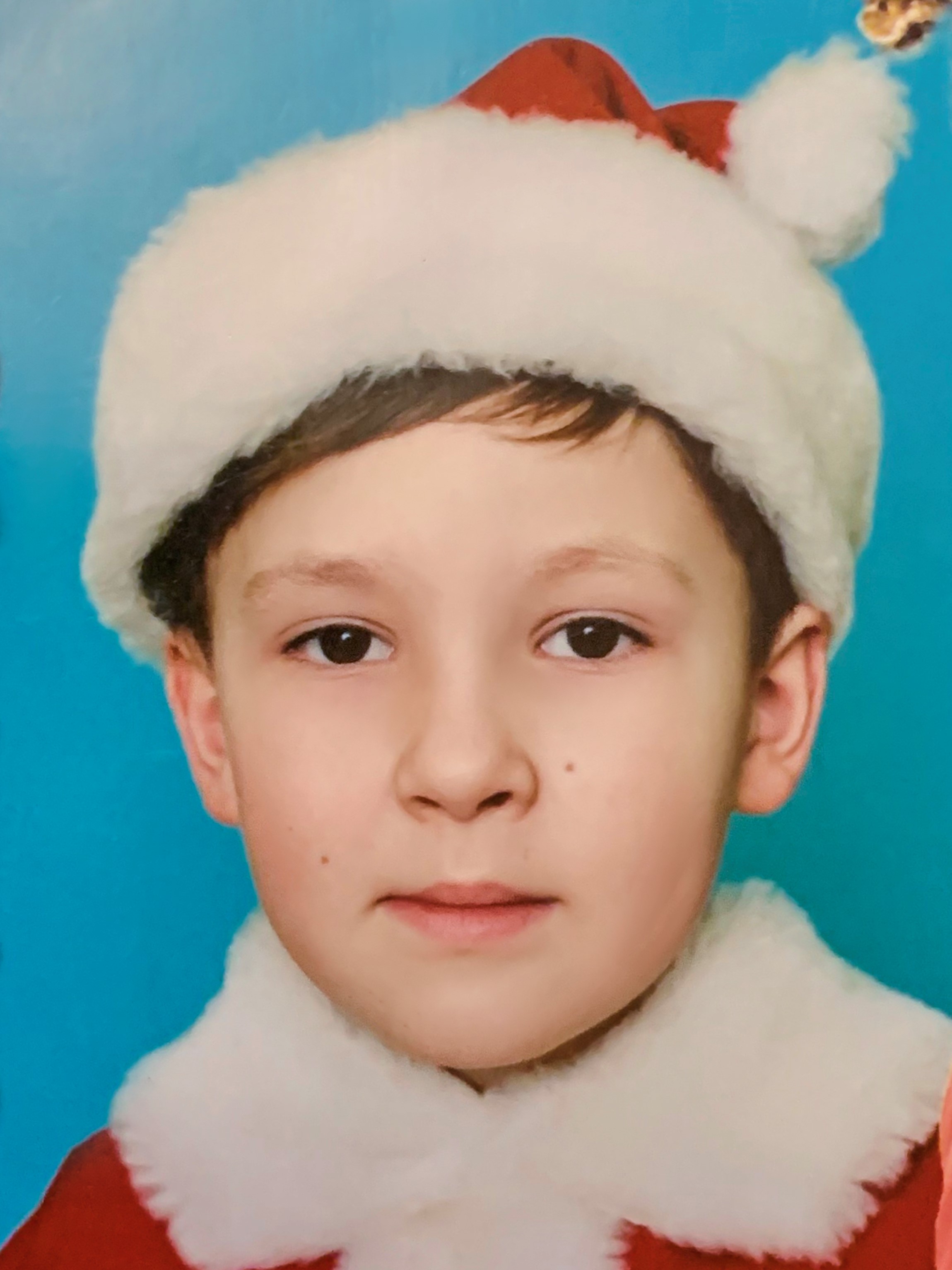 Фоторафия донора CMP-DS-2001